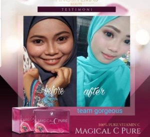 KEBAIKAN &#038; FEEDBACK MAGICAL C PURE -MANFAAT Vitamin C SEBENAR, KOSMETIK CIDA