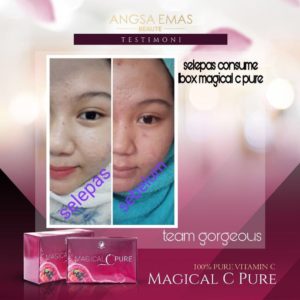 KEBAIKAN &#038; FEEDBACK MAGICAL C PURE -MANFAAT Vitamin C SEBENAR, KOSMETIK CIDA