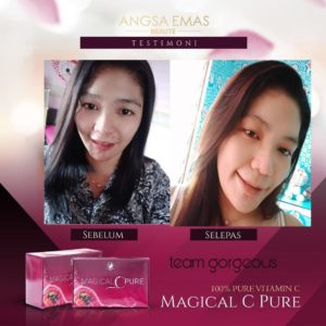 KEBAIKAN &#038; FEEDBACK MAGICAL C PURE -MANFAAT Vitamin C SEBENAR, KOSMETIK CIDA