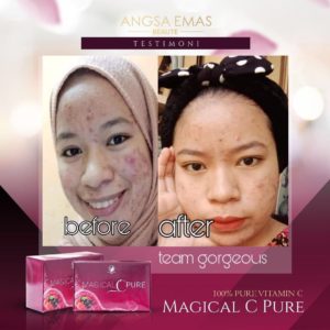 KEBAIKAN &#038; FEEDBACK MAGICAL C PURE -MANFAAT Vitamin C SEBENAR, KOSMETIK CIDA