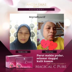 KEBAIKAN &#038; FEEDBACK MAGICAL C PURE -MANFAAT Vitamin C SEBENAR, KOSMETIK CIDA