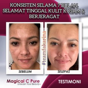 KEBAIKAN &#038; FEEDBACK MAGICAL C PURE -MANFAAT Vitamin C SEBENAR, KOSMETIK CIDA