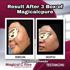 KEBAIKAN &#038; FEEDBACK MAGICAL C PURE -MANFAAT Vitamin C SEBENAR, KOSMETIK CIDA