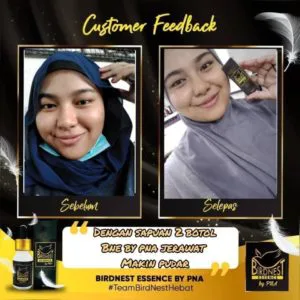Birdnest Essence By Pna Bne 10ml Kosmetik Cida