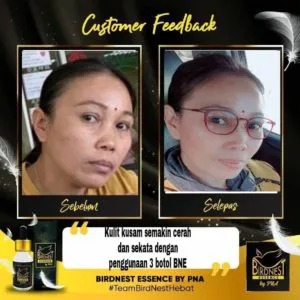 Info Kebaikan Testimoni Birdnest Essence By Pna Bne Kosmetik Cida