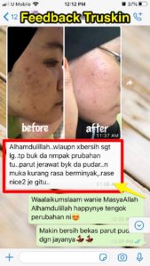 INFO KEBAIKAN FEEDBACK &#8211; TRUSKIN HYDRA BRIGHTENING MOISTURIZER, KOSMETIK CIDA