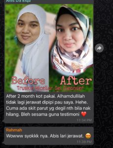 INFO KEBAIKAN FEEDBACK &#8211; TRUSKIN HYDRA BRIGHTENING MOISTURIZER, KOSMETIK CIDA