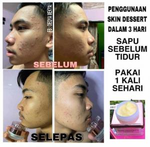 INFO &#038; TESTIMONI REPAIRING MOISTURISER SKIN DESSERT, KOSMETIK CIDA