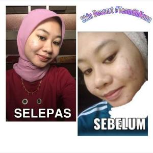 INFO &#038; TESTIMONI REPAIRING MOISTURISER SKIN DESSERT, KOSMETIK CIDA