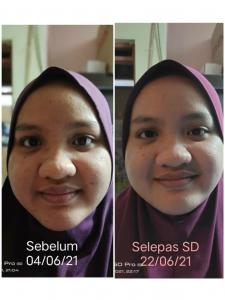 INFO &#038; TESTIMONI REPAIRING MOISTURISER SKIN DESSERT, KOSMETIK CIDA