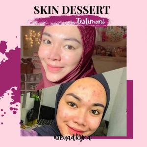 INFO &#038; TESTIMONI REPAIRING MOISTURISER SKIN DESSERT, KOSMETIK CIDA