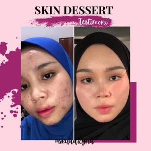 INFO &#038; TESTIMONI REPAIRING MOISTURISER SKIN DESSERT, KOSMETIK CIDA