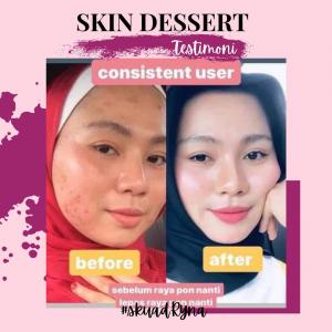 INFO &#038; TESTIMONI REPAIRING MOISTURISER SKIN DESSERT, KOSMETIK CIDA