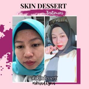 INFO &#038; TESTIMONI REPAIRING MOISTURISER SKIN DESSERT, KOSMETIK CIDA