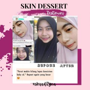 INFO &#038; TESTIMONI REPAIRING MOISTURISER SKIN DESSERT, KOSMETIK CIDA