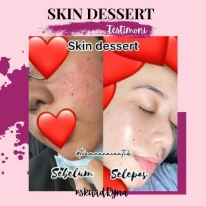 INFO &#038; TESTIMONI REPAIRING MOISTURISER SKIN DESSERT, KOSMETIK CIDA