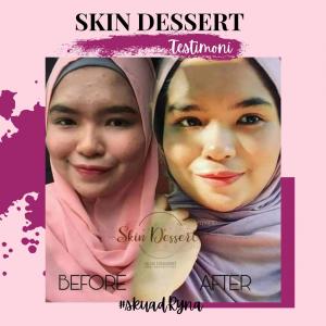 INFO &#038; TESTIMONI REPAIRING MOISTURISER SKIN DESSERT, KOSMETIK CIDA