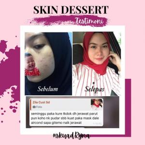 INFO &#038; TESTIMONI REPAIRING MOISTURISER SKIN DESSERT, KOSMETIK CIDA