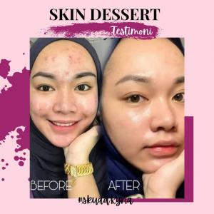 INFO &#038; TESTIMONI REPAIRING MOISTURISER SKIN DESSERT, KOSMETIK CIDA