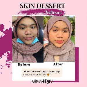 INFO &#038; TESTIMONI REPAIRING MOISTURISER SKIN DESSERT, KOSMETIK CIDA