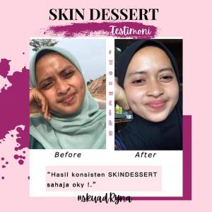 INFO &#038; TESTIMONI REPAIRING MOISTURISER SKIN DESSERT, KOSMETIK CIDA